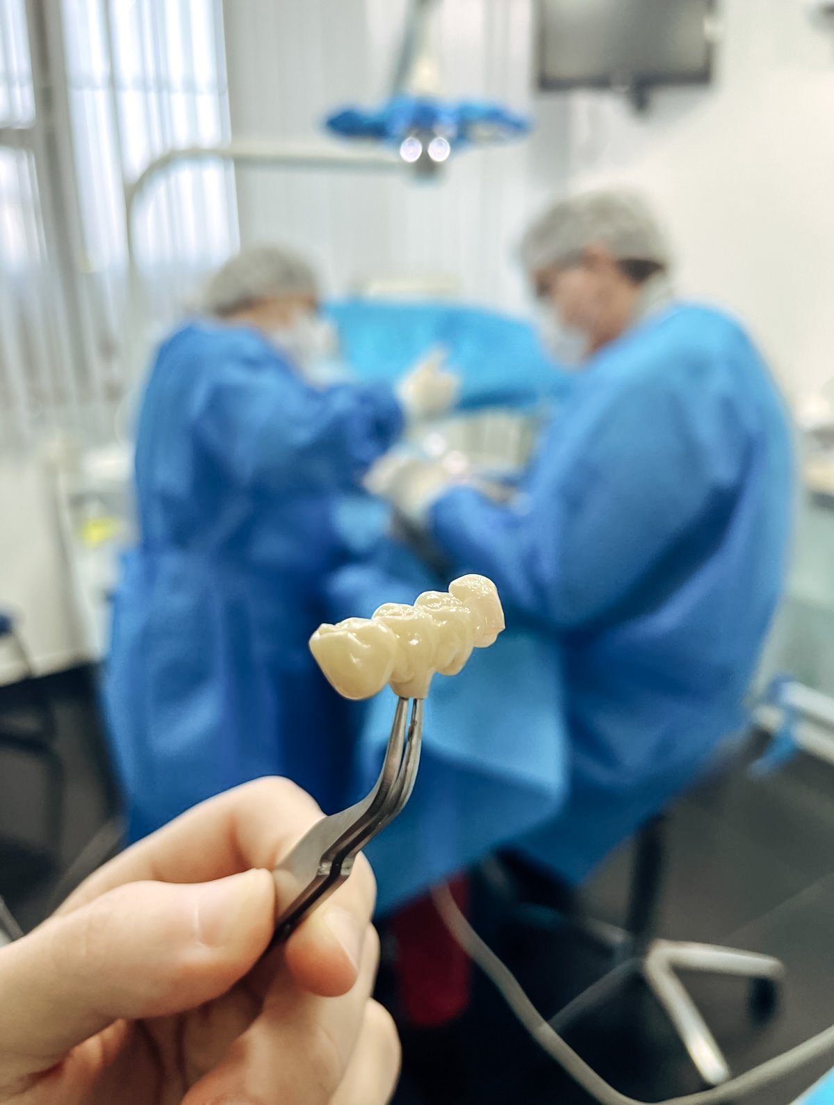 Implante dental no Méier